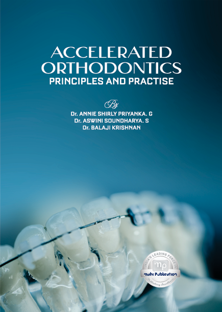 Accelerated Orthodontics Principles And Practise