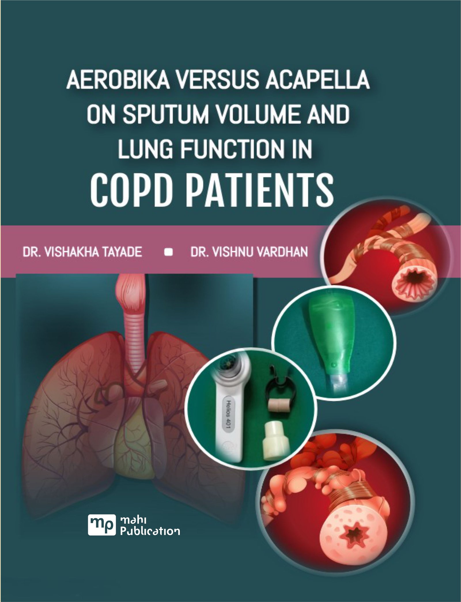 Aerobika versus Acapella on Sputum Volume and Lung Function in COPD Patients