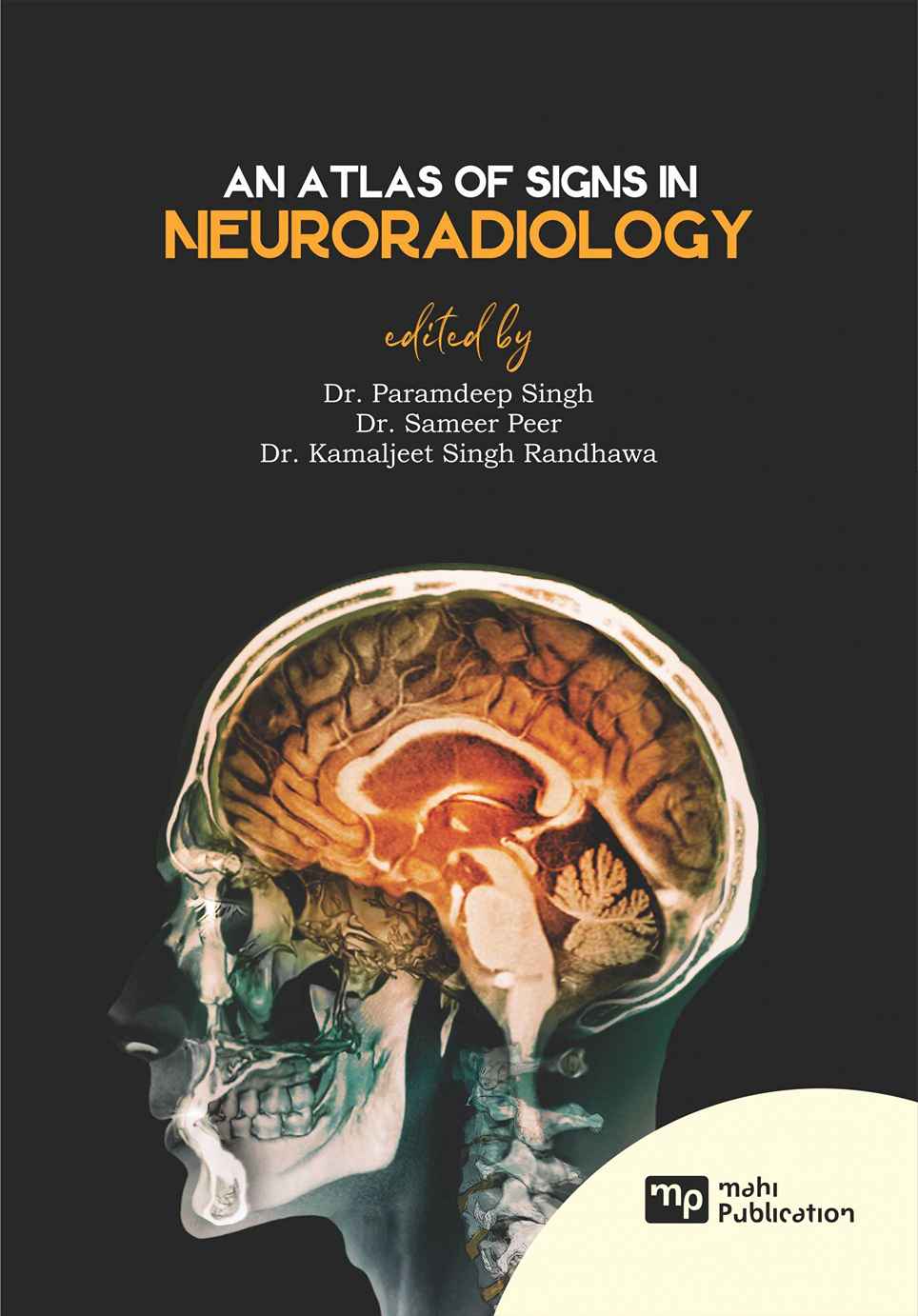 An Atlas of Signs in Neuroradiology