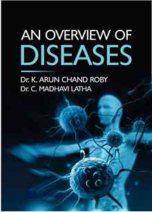 An Overview Of Diseases