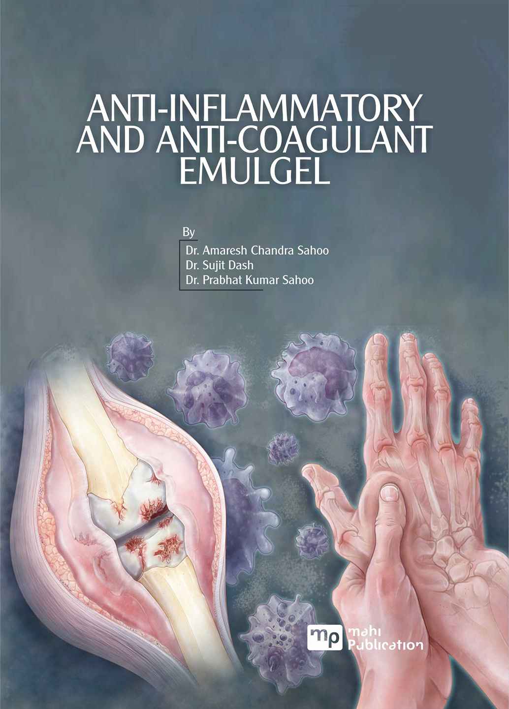 Anti-inflammatory and Anti-coagulant Emulgel