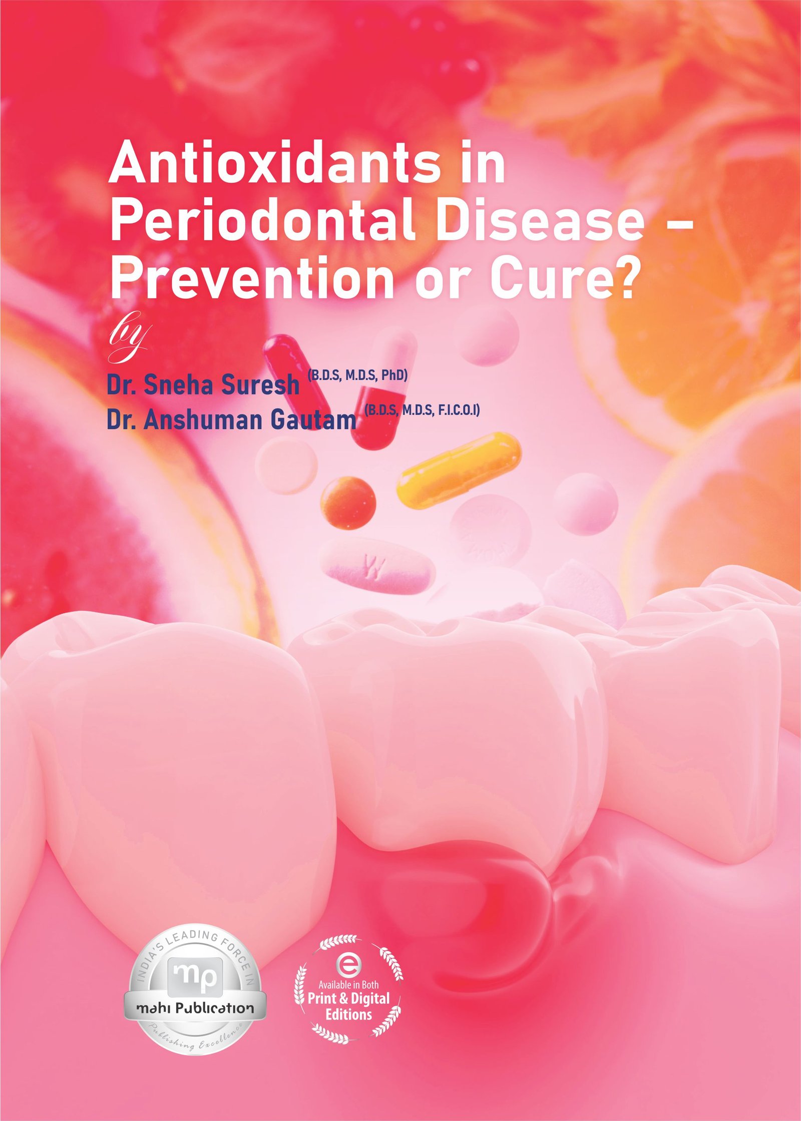 Antioxidants in Periodontal Disease – Prevention Or Cure?