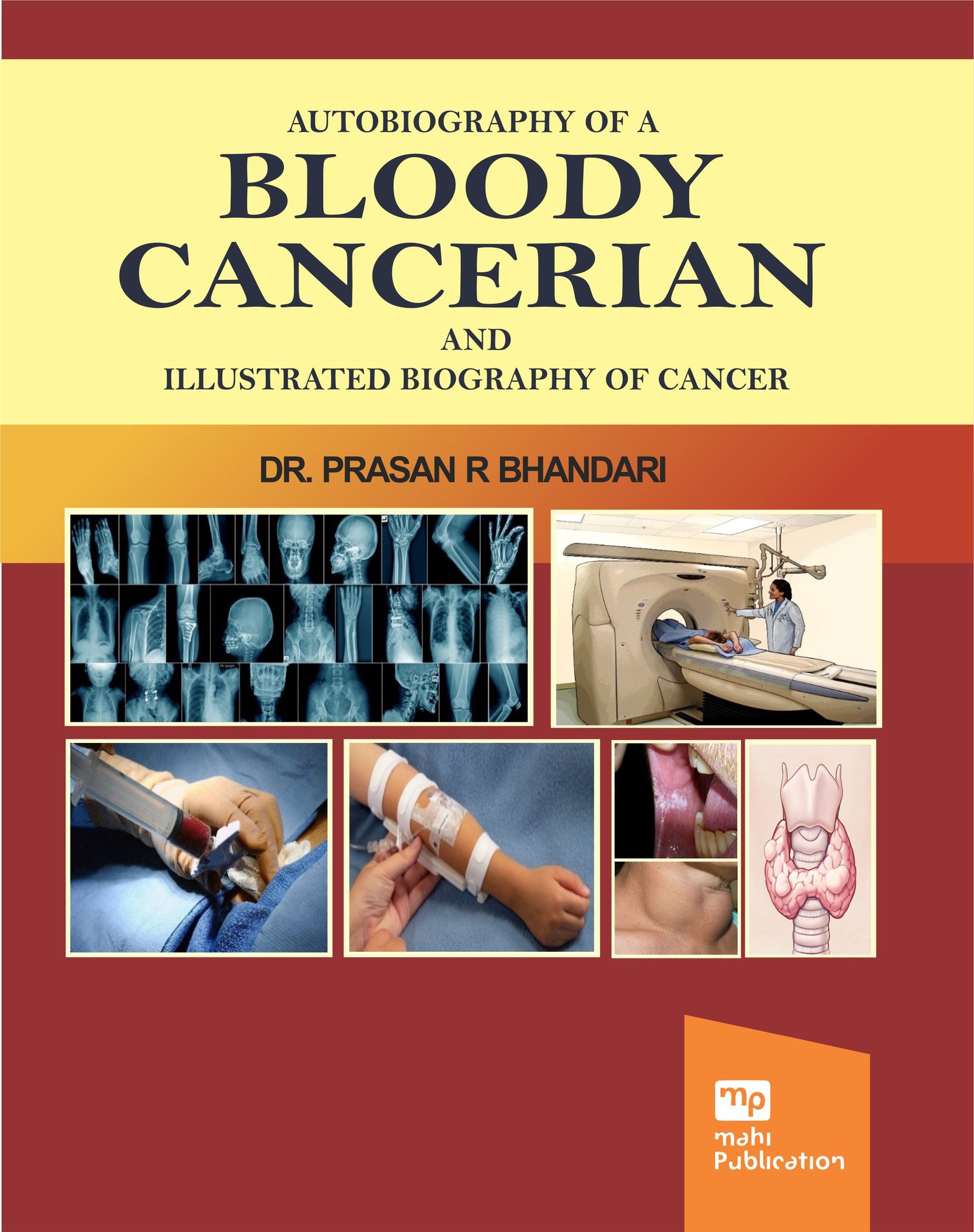 Autobiography of a Bloody Cancerian and Illustrated Biography of Cancer