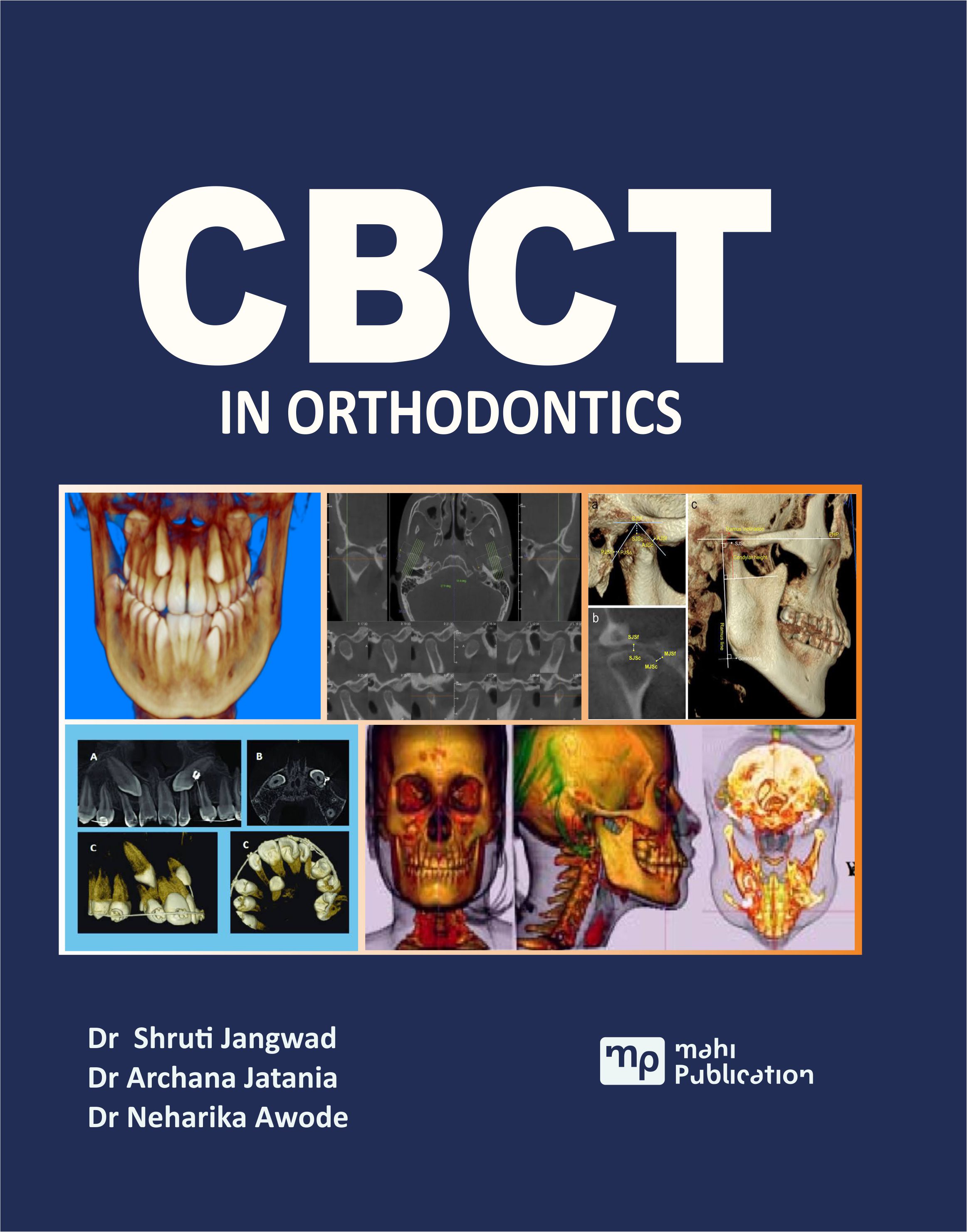 CBCT In Orthodontics