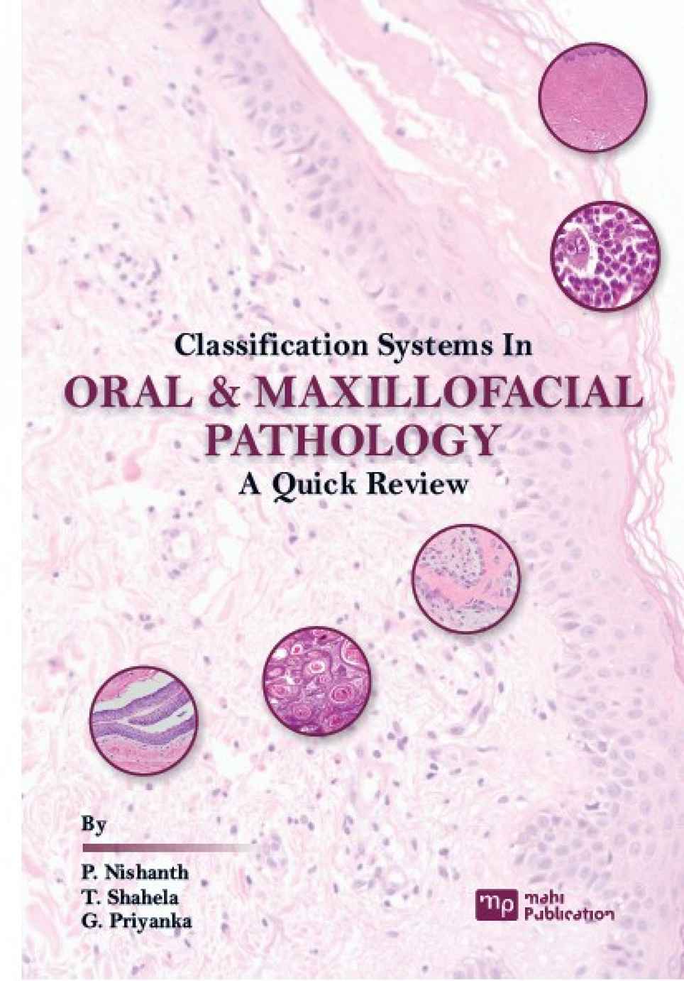 Classification Systems In Oral & MaXIllofacial Pathology A Quick Review