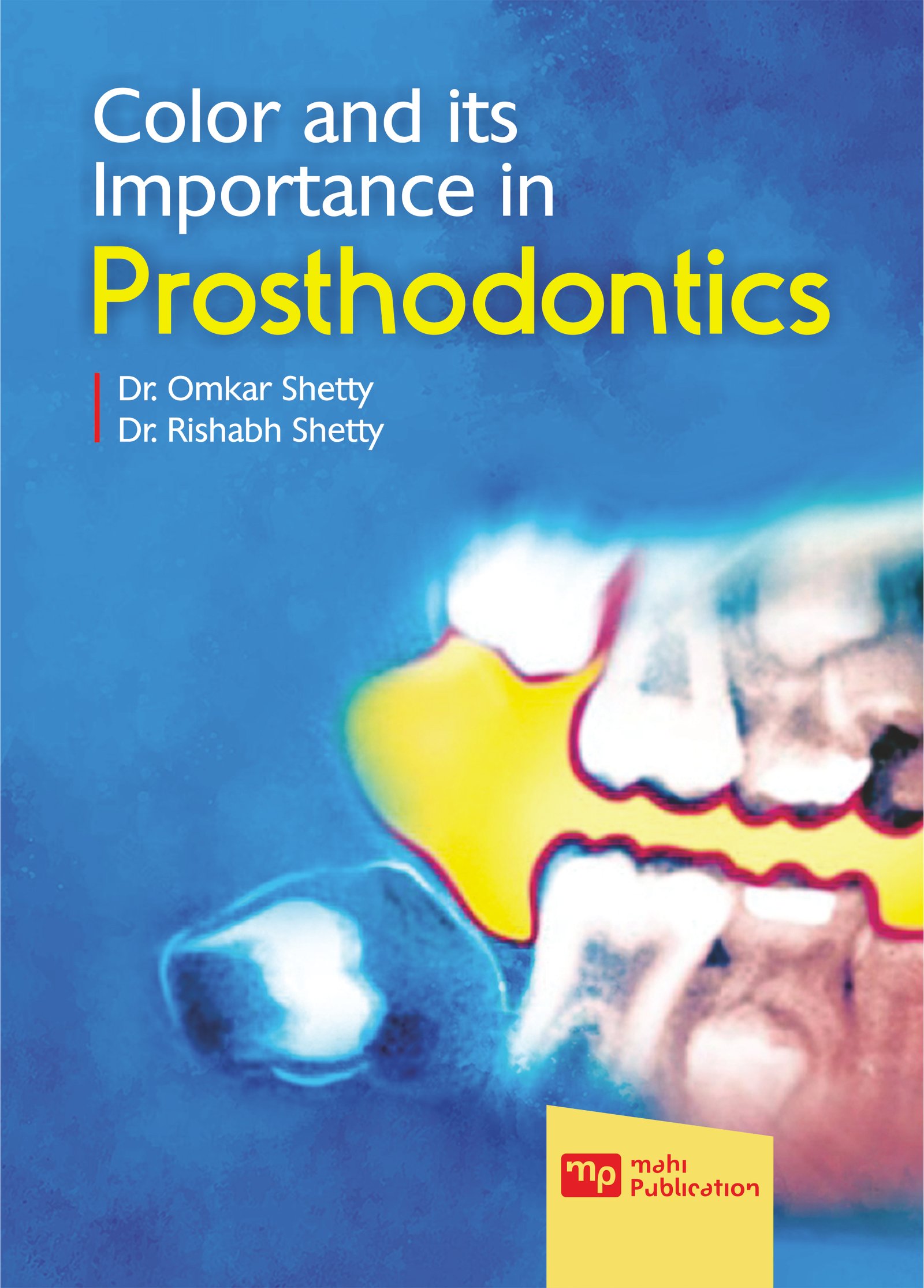 Color And Its Importance In Prosthodontics