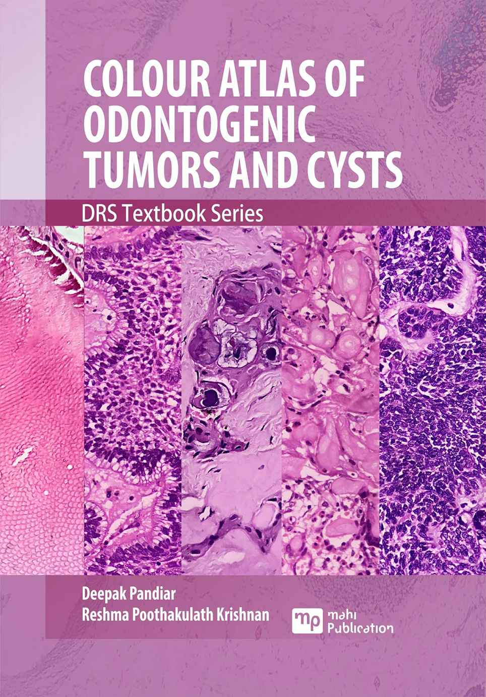 Colour Atlas of Odontogenic Tumors and Cysts DRS Textbook Series