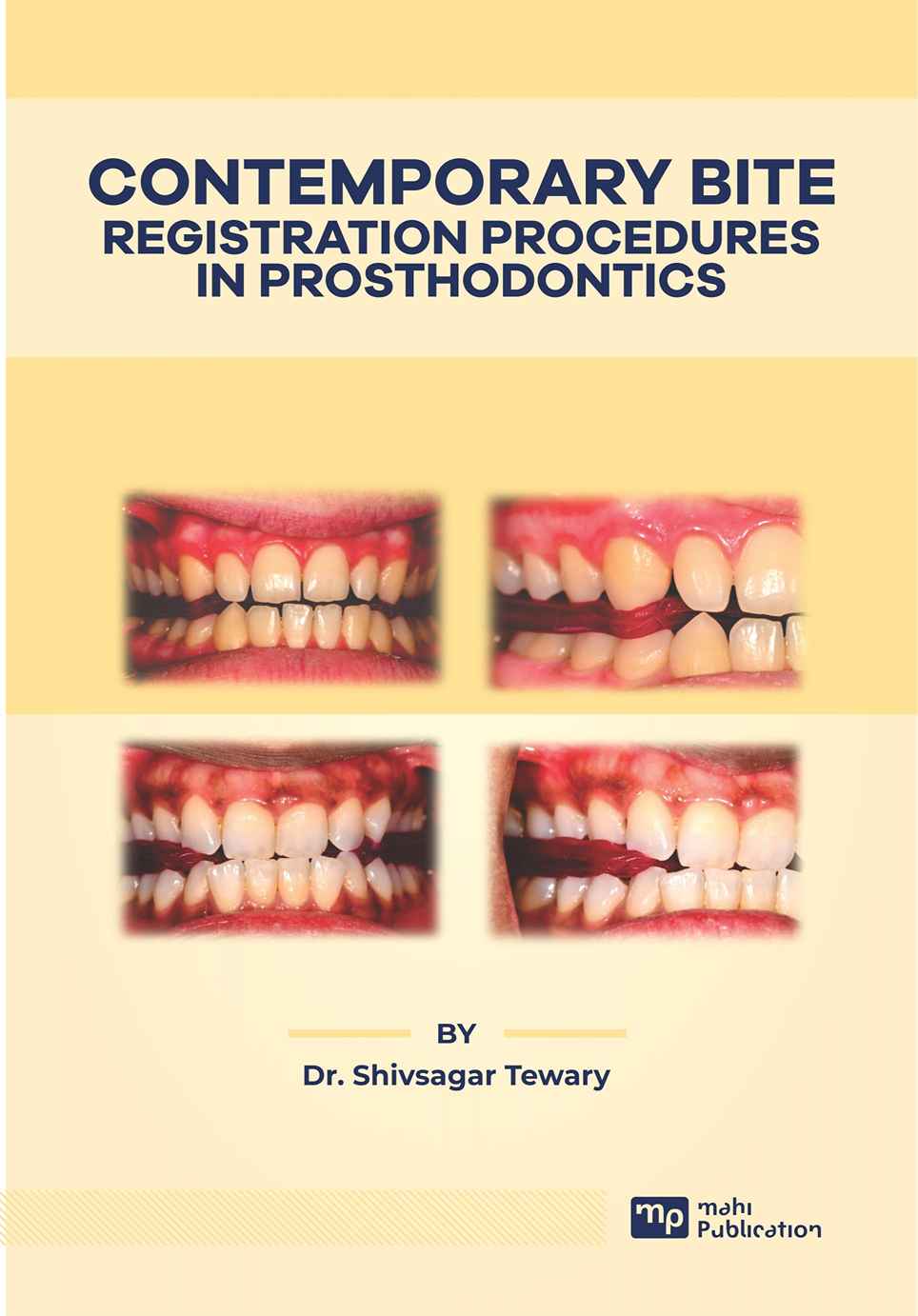 Contemporary Bite – Registration Procedures In Prosthodontics