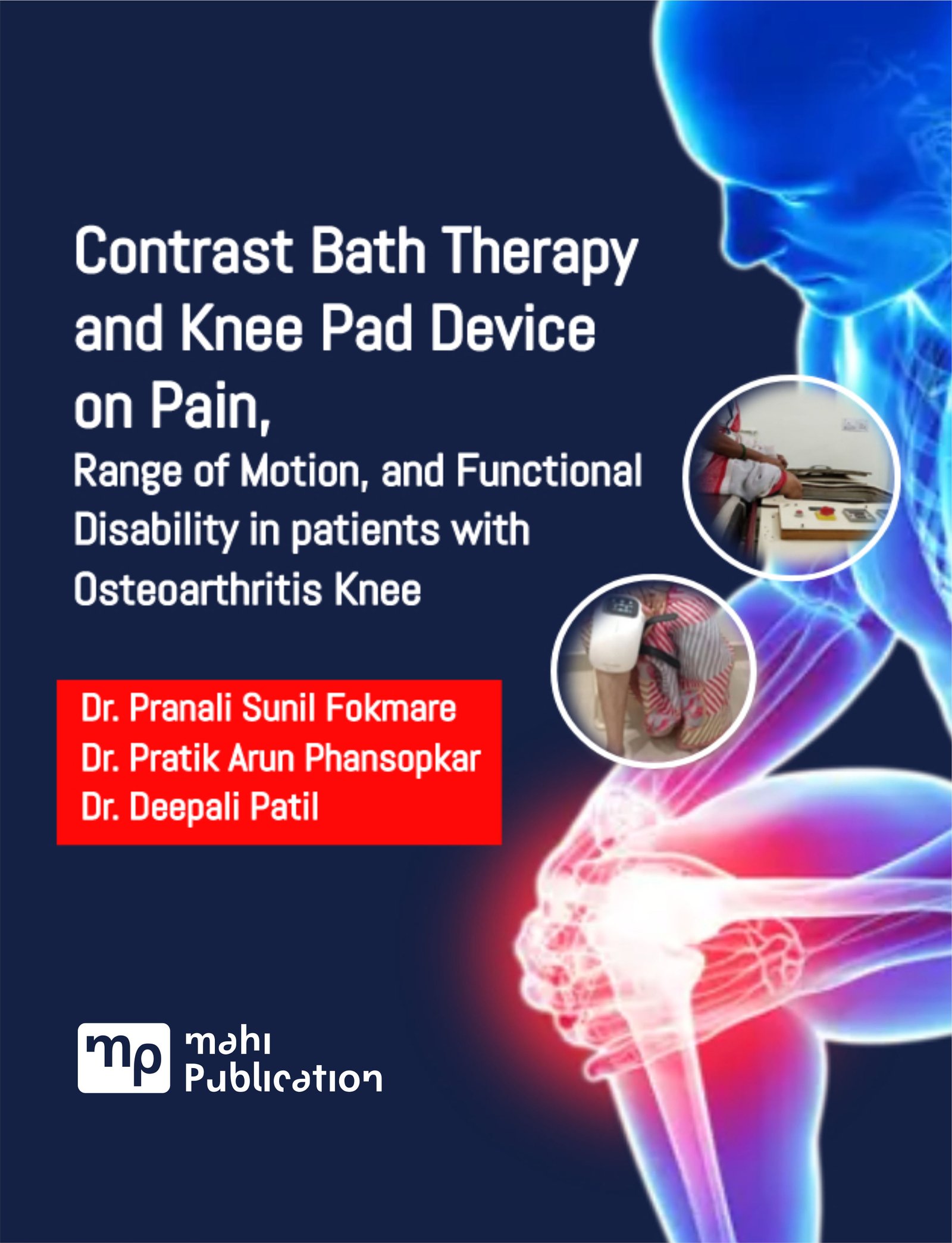 Contrast Bath Therapy and Knee Pad Device on Pain, Range of Motion, and Functional Disability in patients with Osteoarthritis Knee