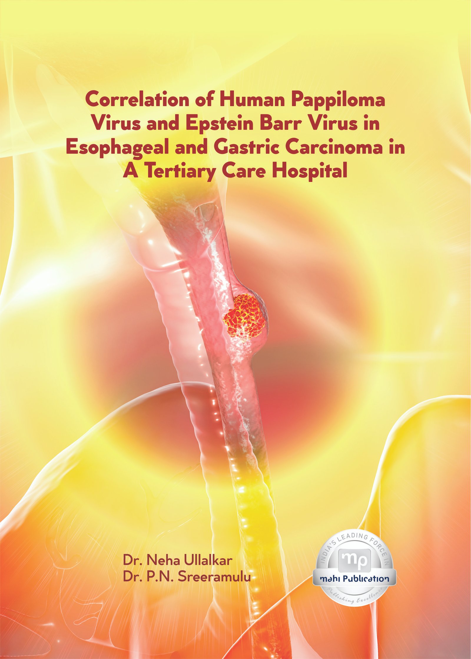 Correlation of Human Pappiloma Virus and Epstein Barr Virus in Esophageal and Gastric Carcinoma in a Tertiary Care Hospital