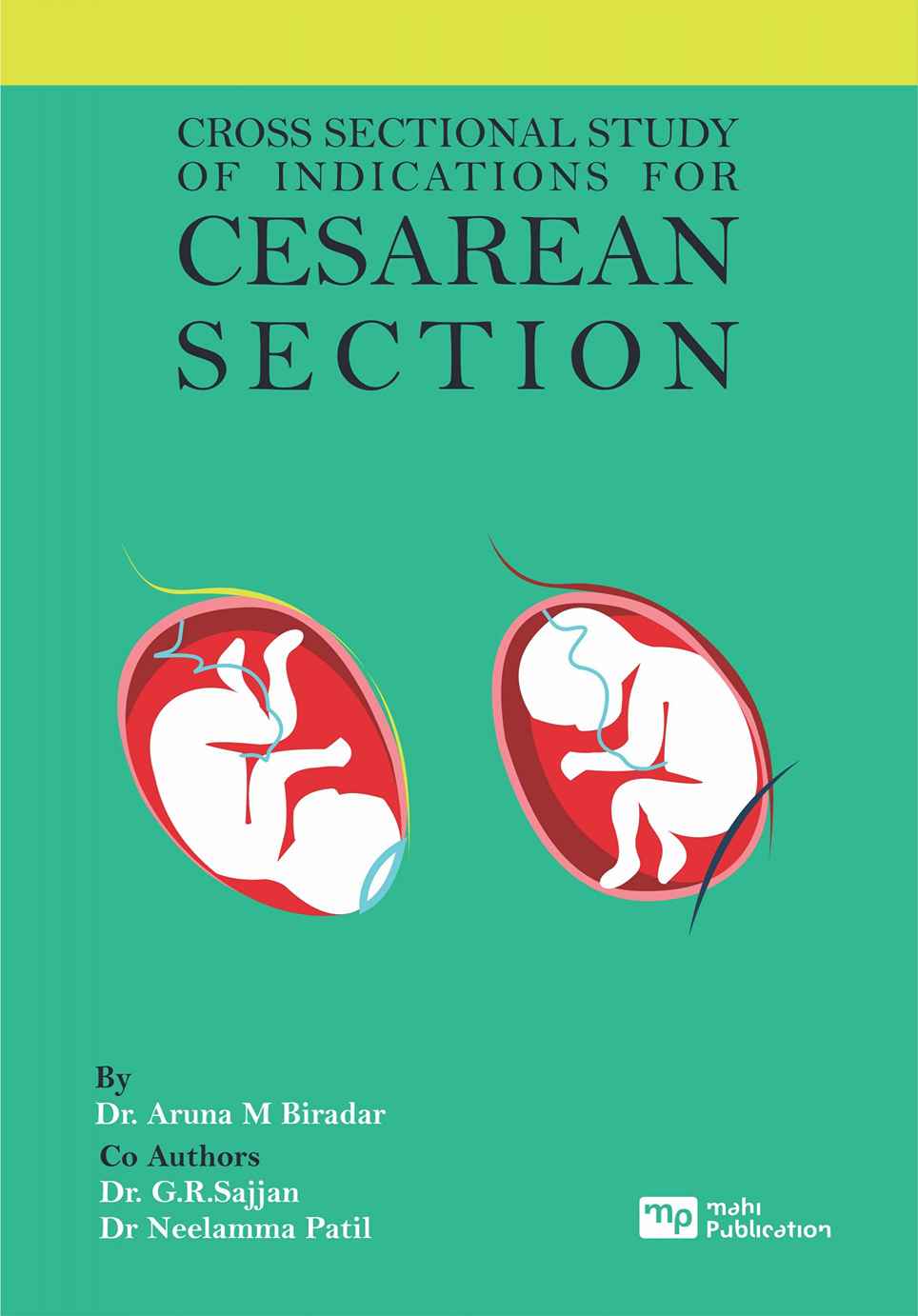 Cross Sectional Study Of Indications For Cesarean Section