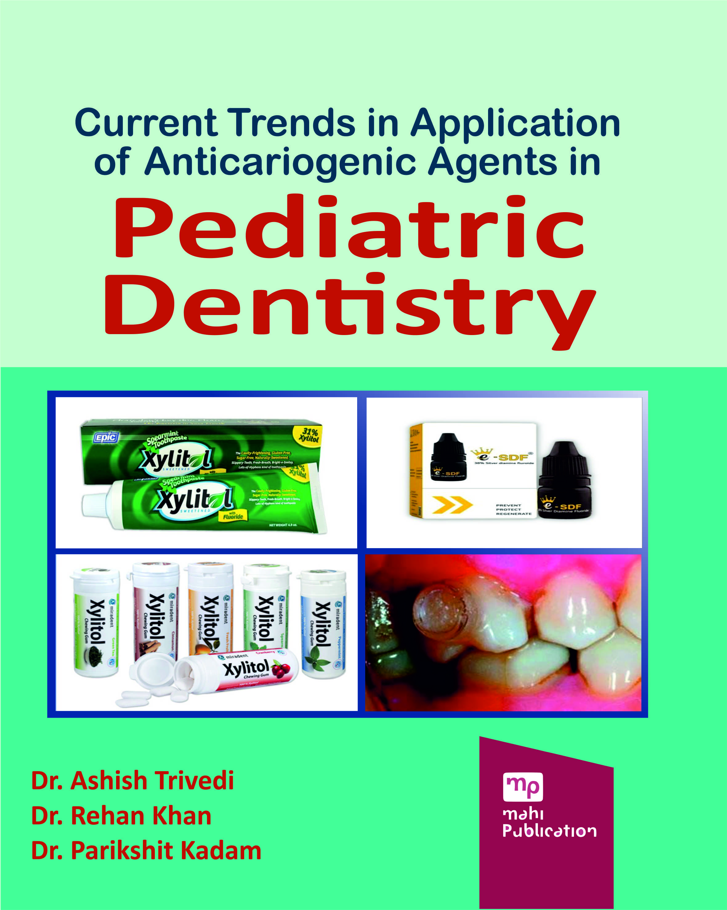 Current Trends In Application Of Anticariogenic Agents In Pediatric Dentistry