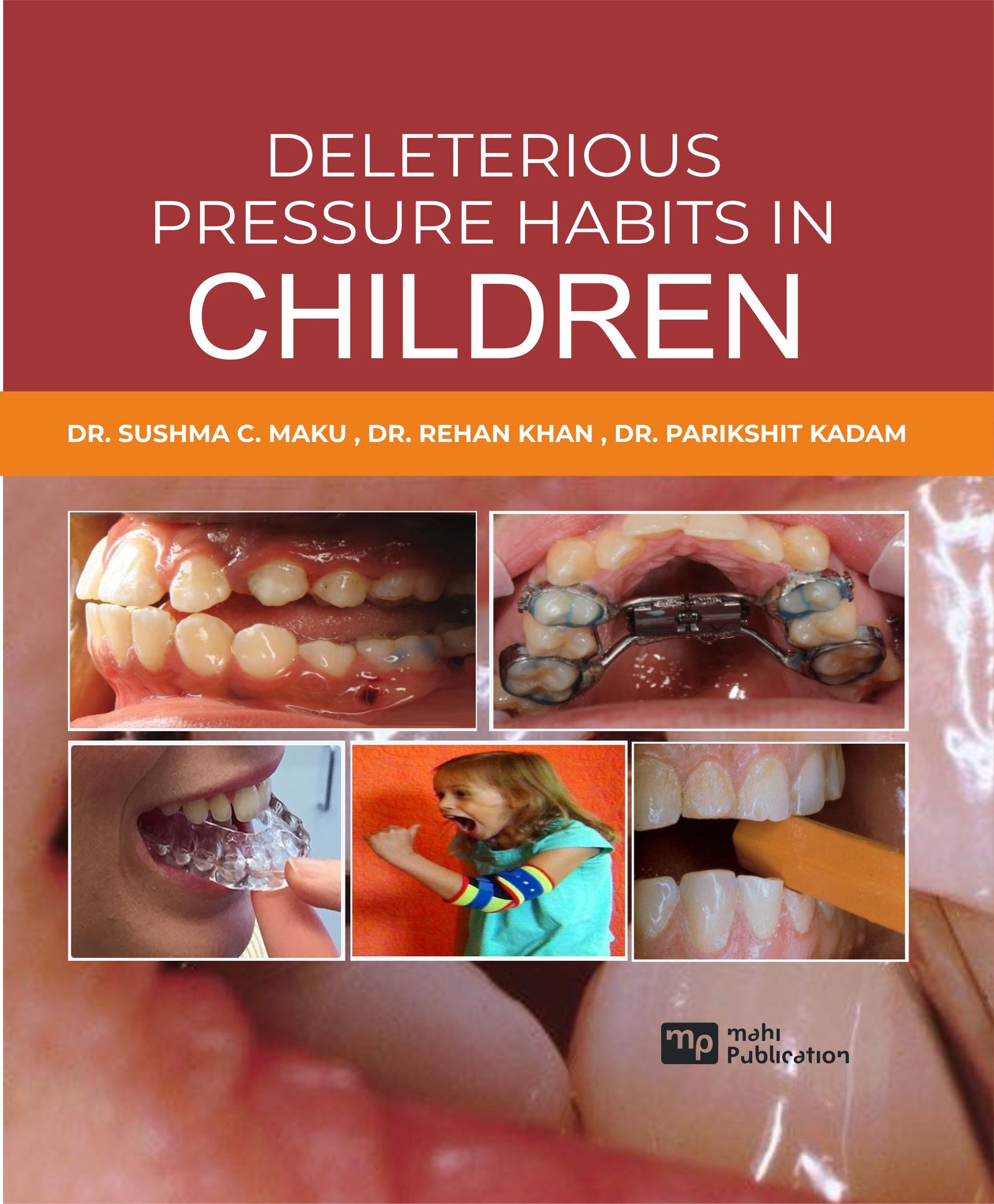 Deleterious Pressure Habits In Children