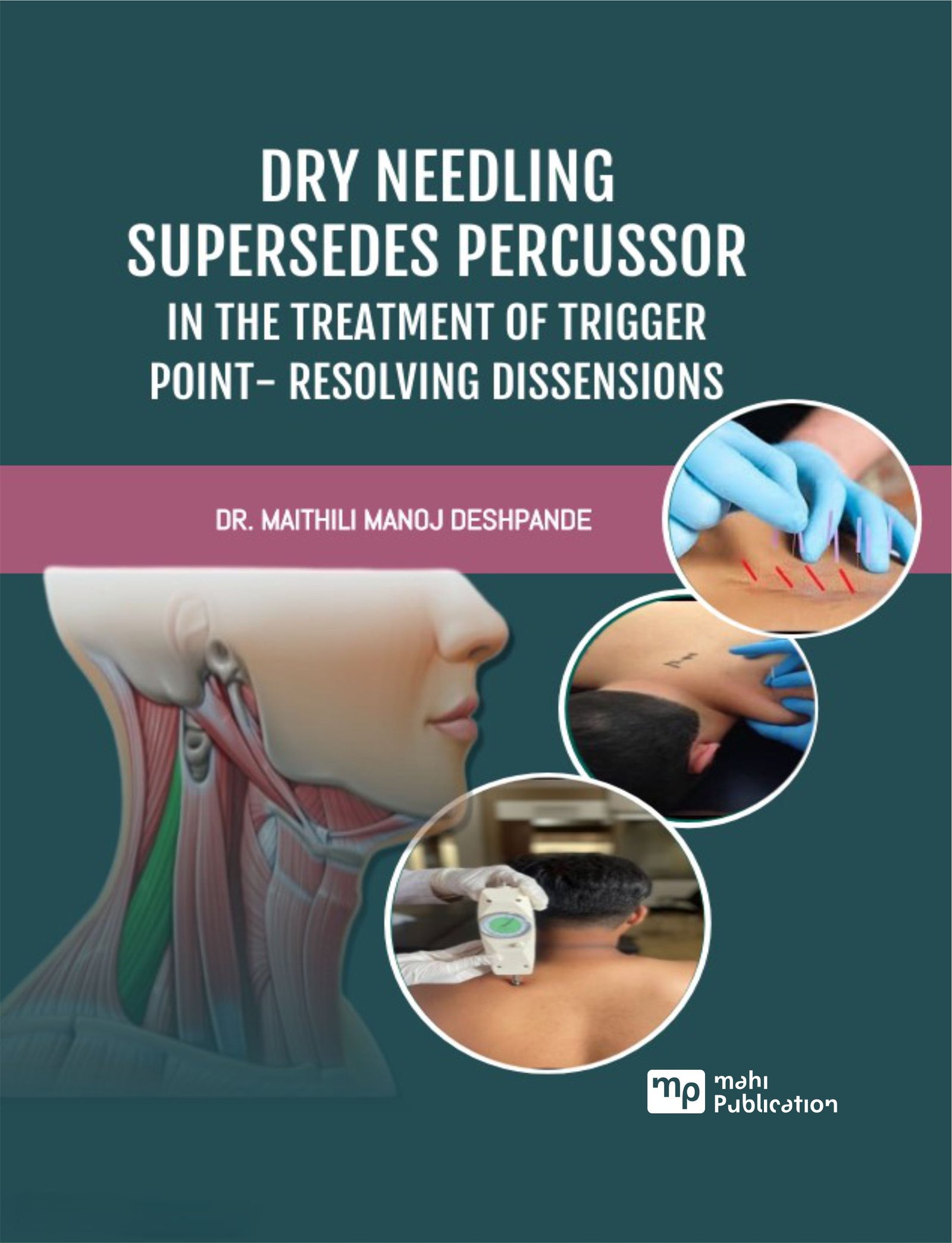 Dry Needling Supersedes Percussor in the treatment of Trigger Point- Resolving Dissensions