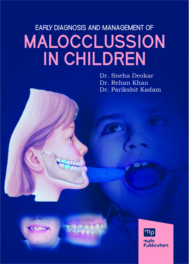 Early Diagnosis And Management Of Malocclussion In Children