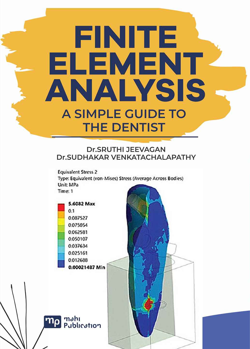 Finite element analysisA simple guide to the dentist