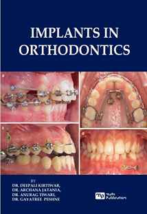 Implants in Orthodontics