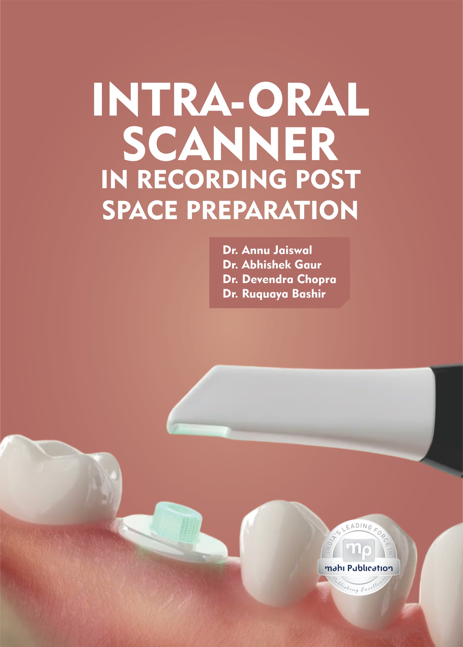 Intra-Oral Scanner in Recording Post Space Preparation