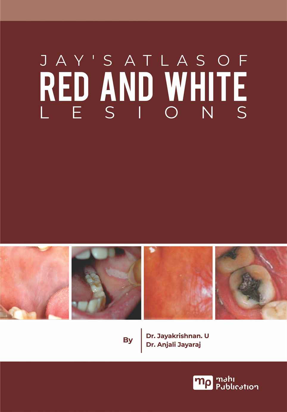 Jay's Atlas Of Red And White Lesions