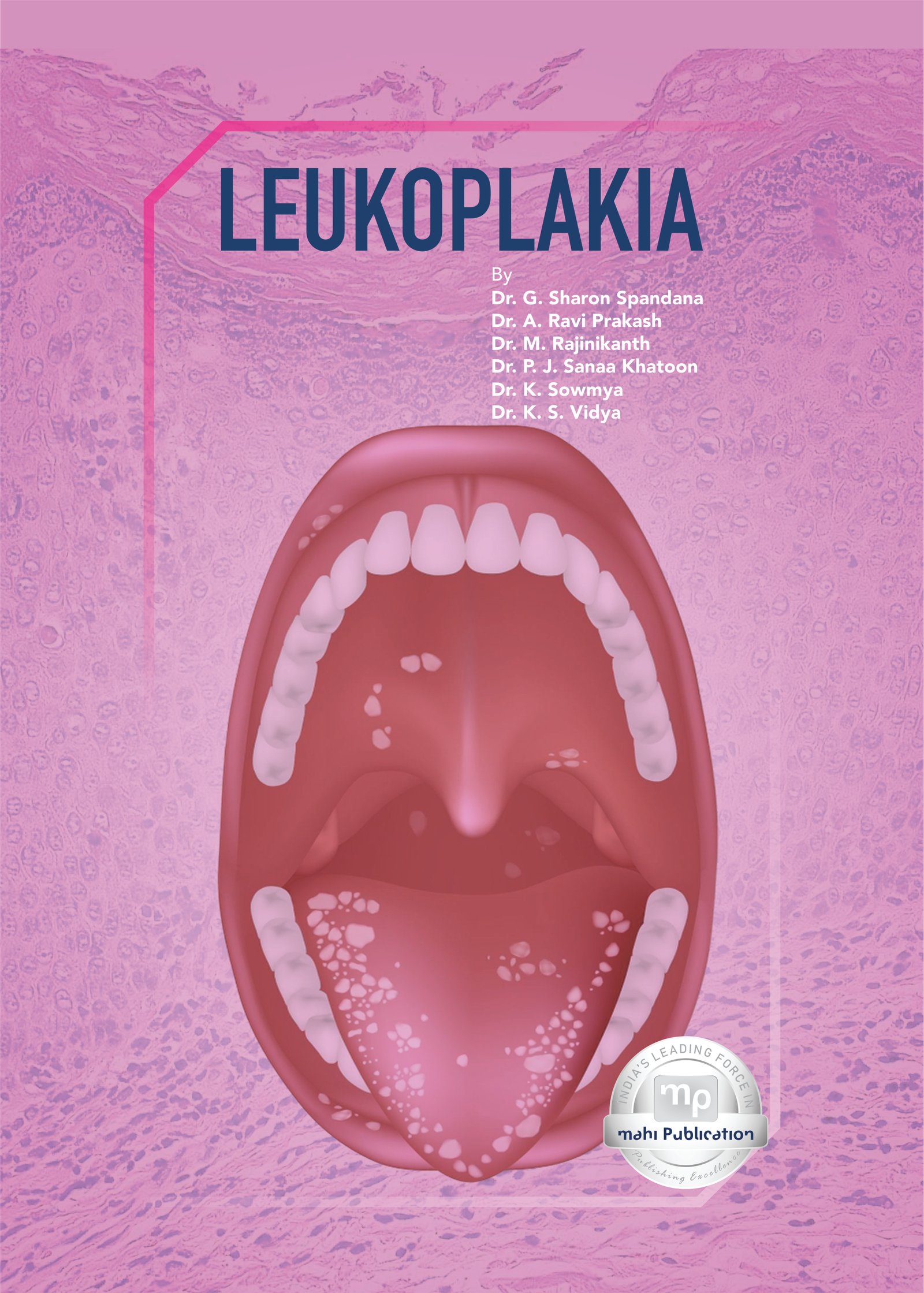 Leukoplakia
