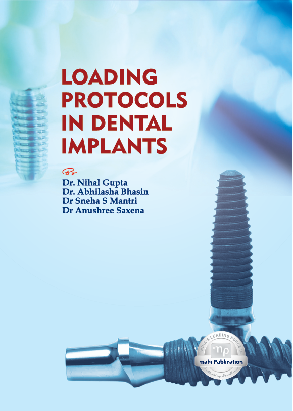 Loading Protocols in Dental Implants