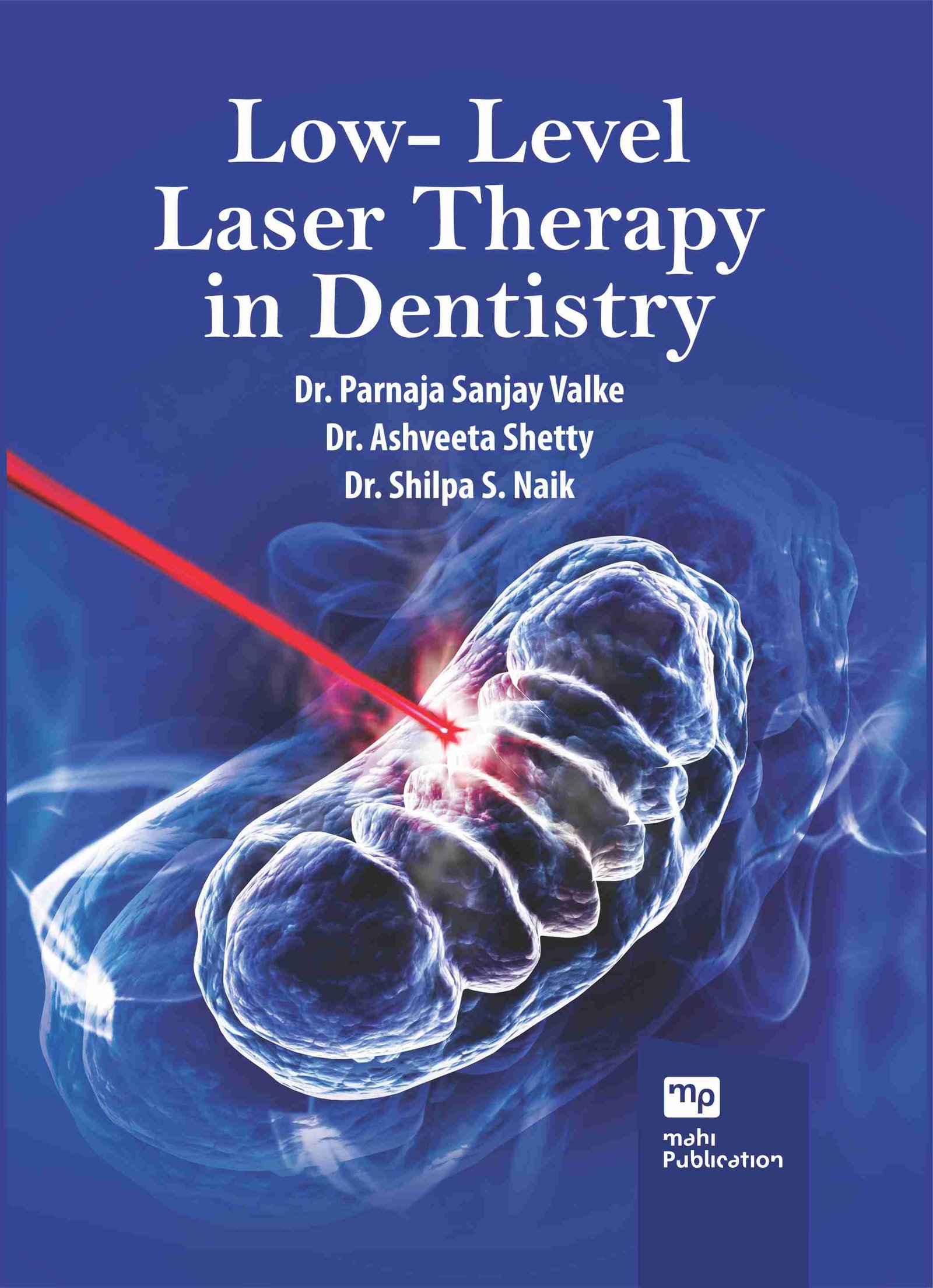 Low- Level Laser Therapy In Dentistry