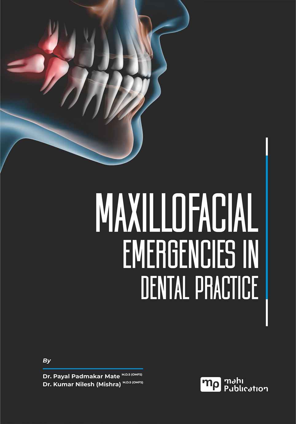 MaXIllofacial Emergencies In Dental Practice