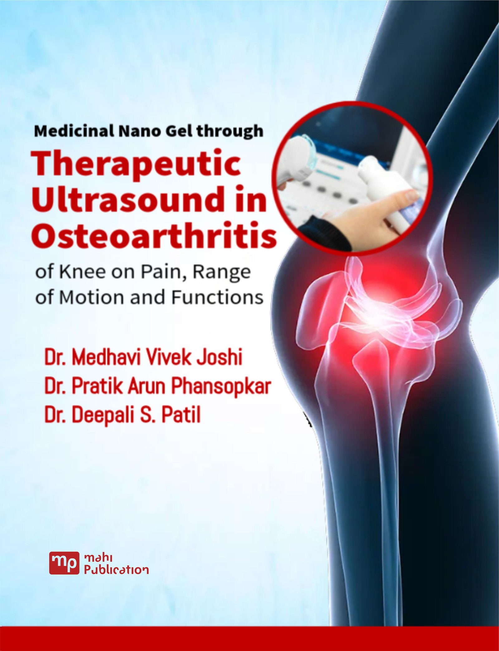 Medicinal Nano Gel through Therapeutic Ultrasound in Osteoarthritis of Knee on Pain, Range of Motion and Functions