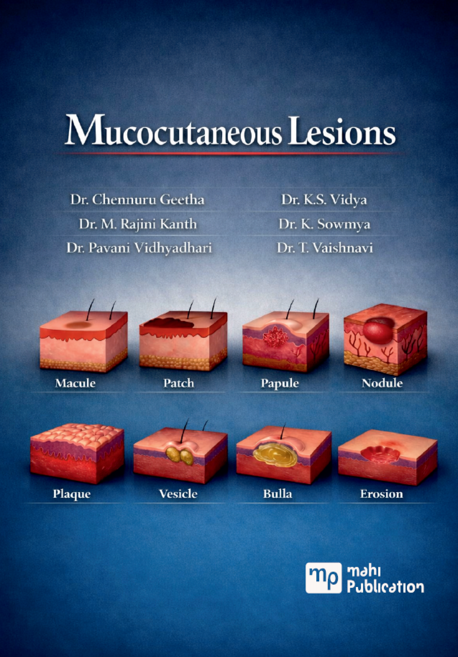 Mucocutaneous Lesions