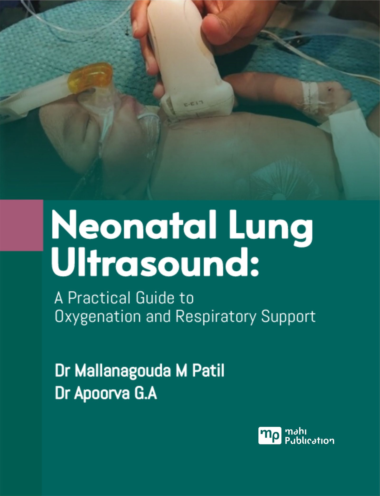 Neonatal Lung Ultrasound: A Practical Guide to Oxygenation and Respiratory Support