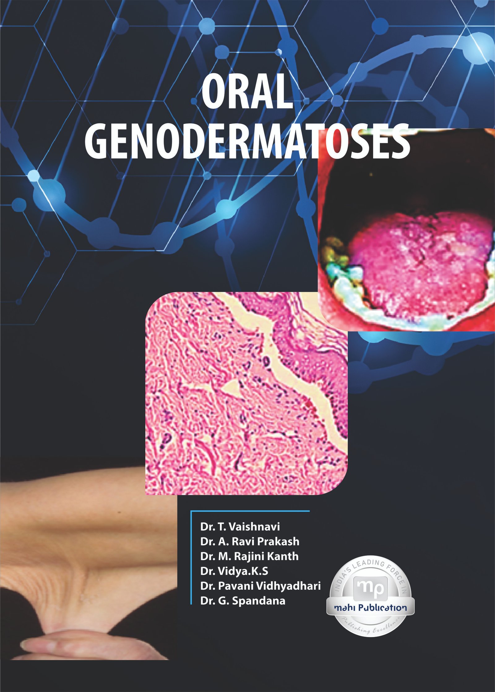 Oral Genodermatoses