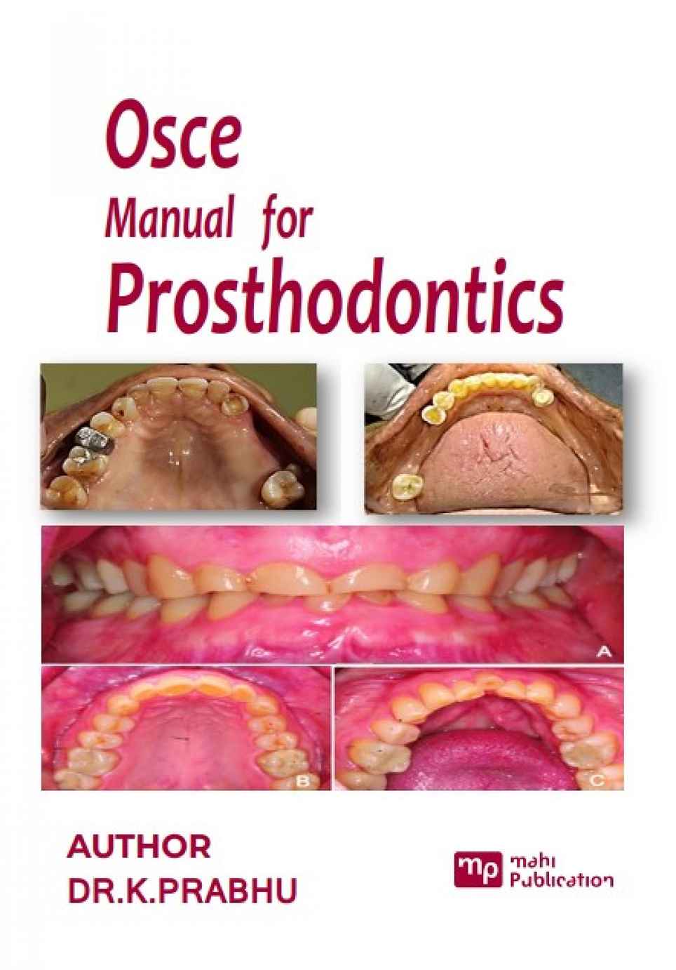 OSCE Manual for Prosthodontics