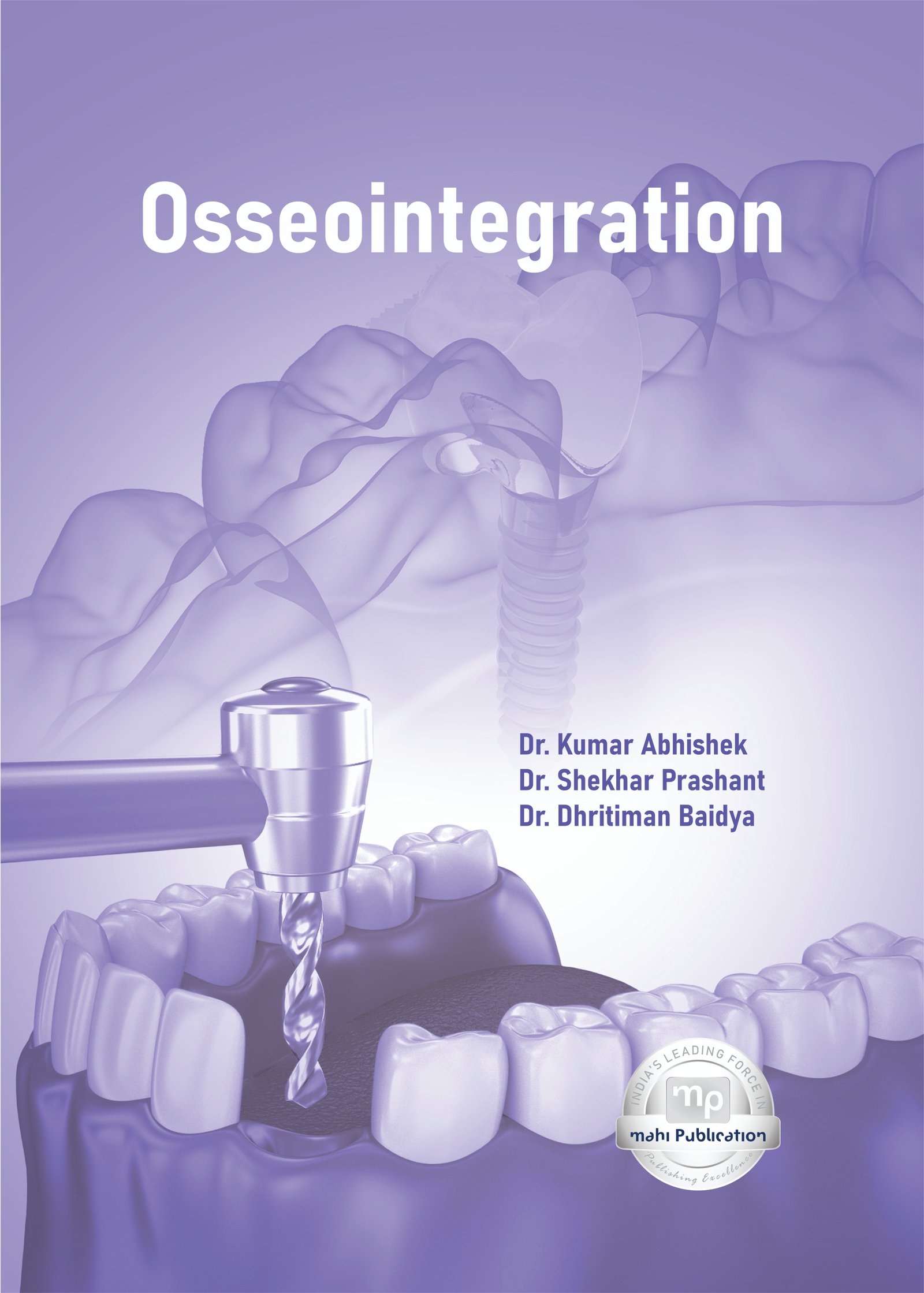 Osseointegration