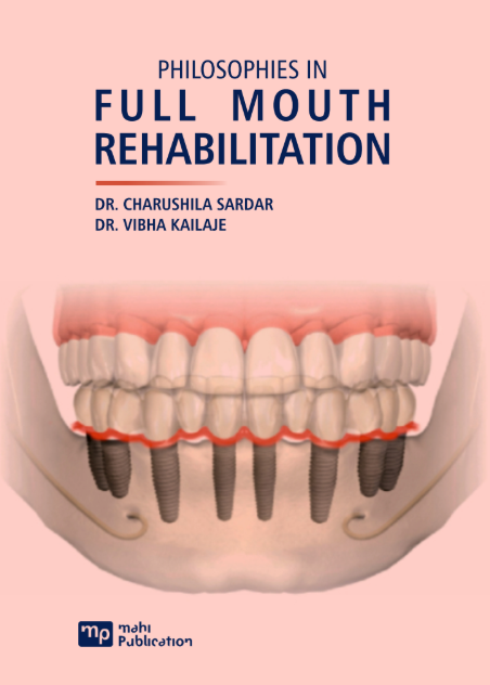 Philosophies In Full Mouth Rehabilitation