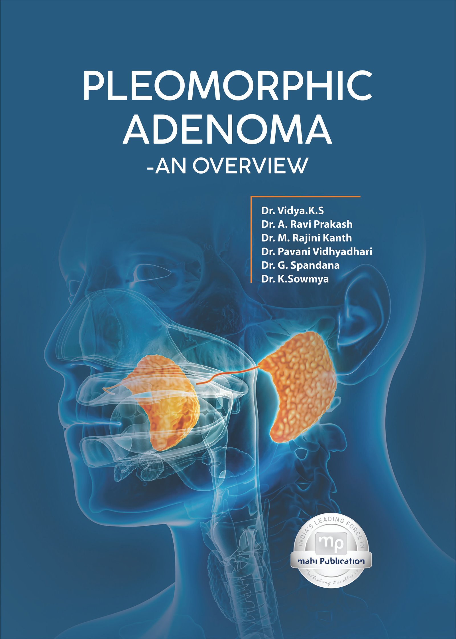 Pleomorphic Adenoma - An Overview