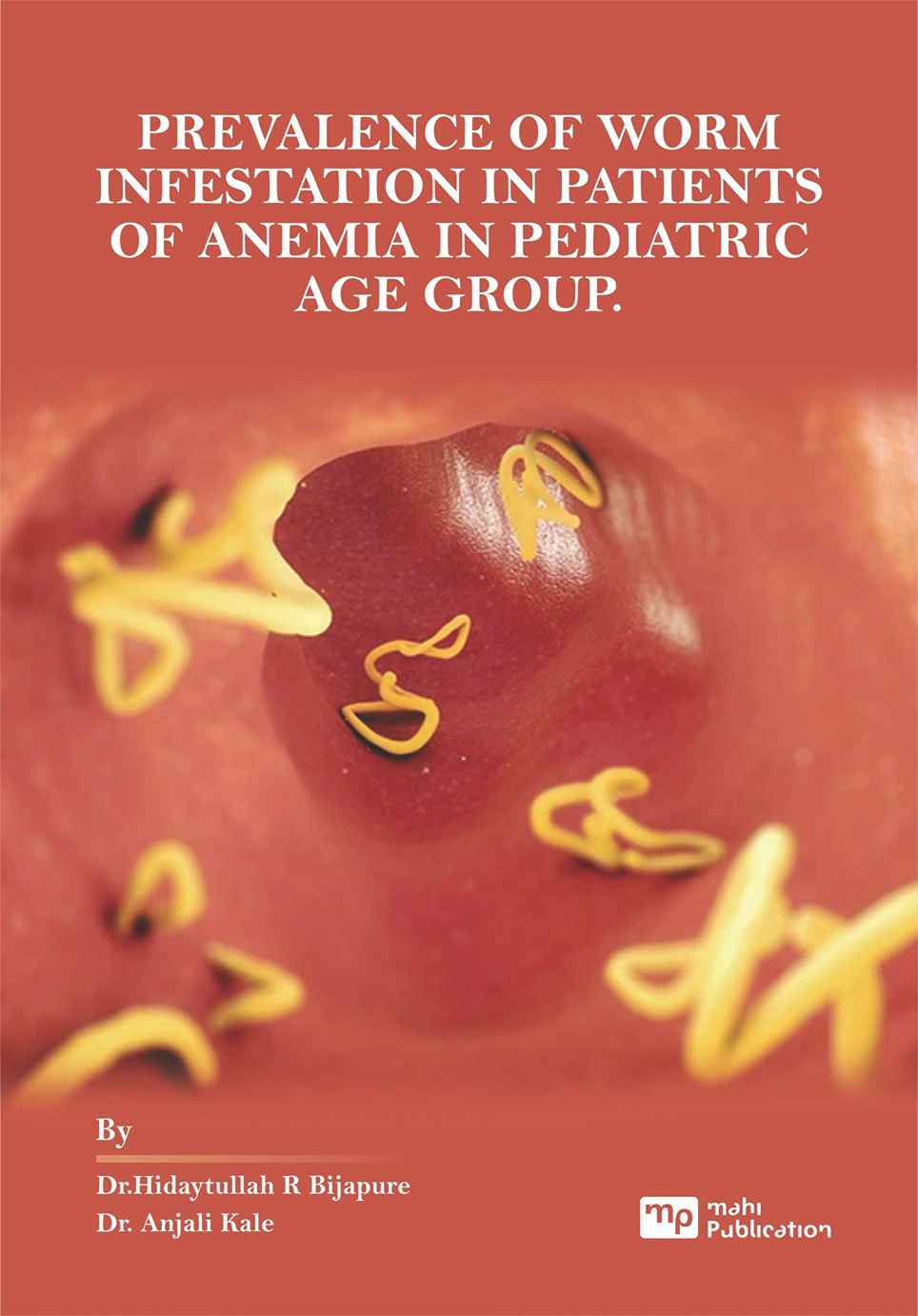 Prevalence Of Worm Infestation In Patients Of Anemia In Pediatric Age Group