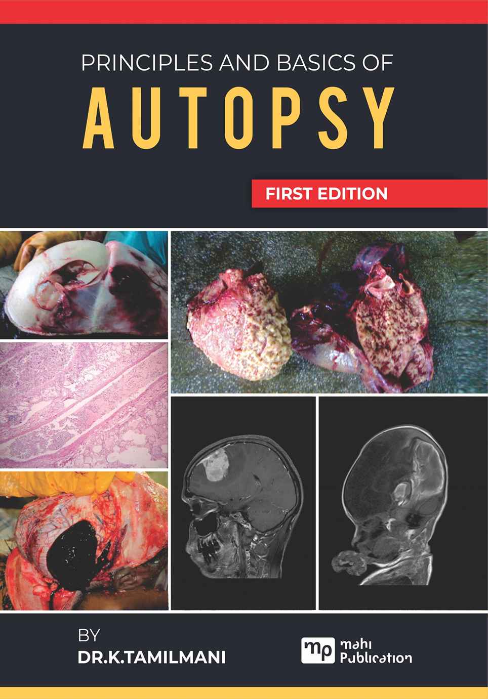 Principles And Basics Of Autopsy