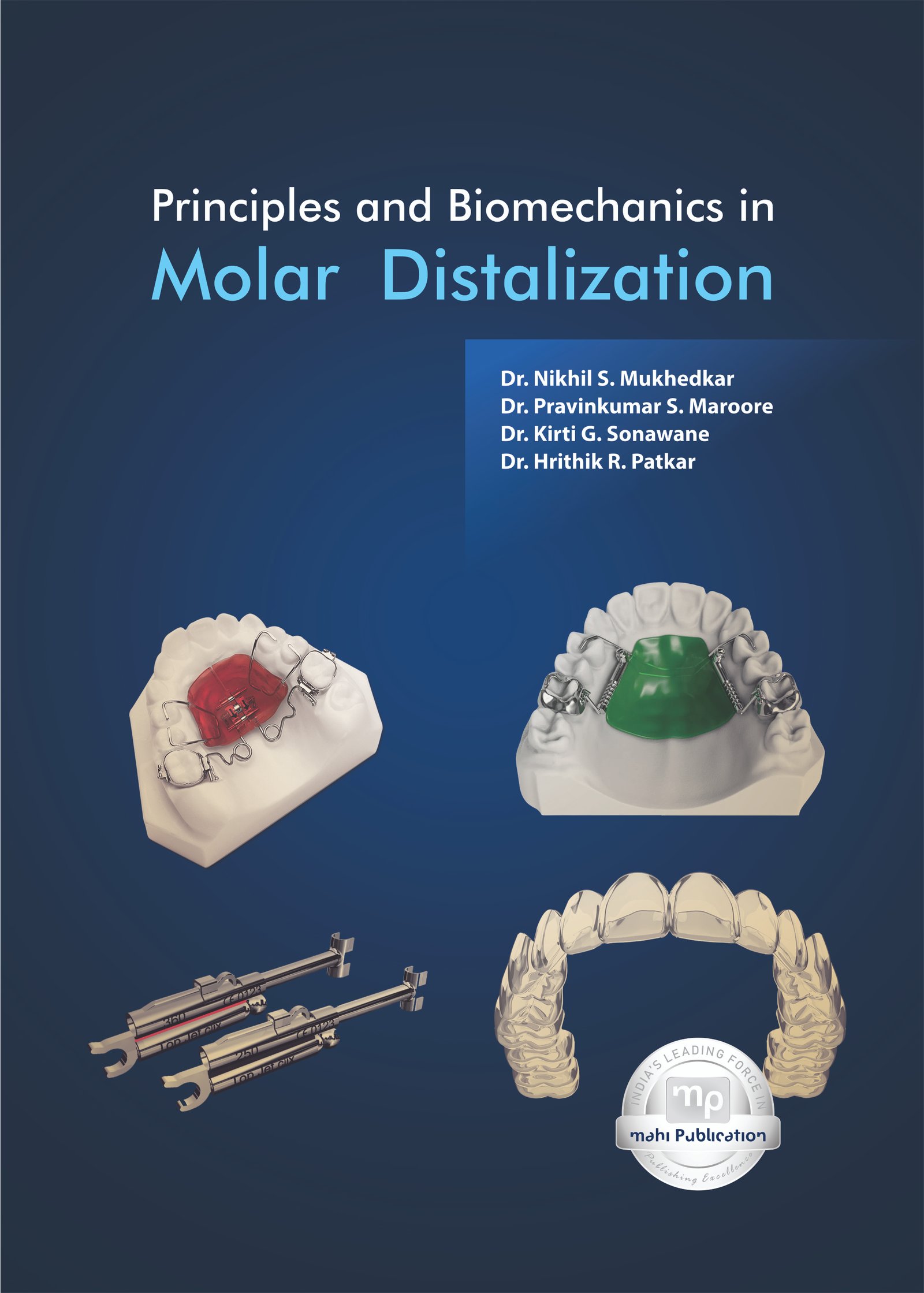 Principles and Biomechanics in Molar Distalization