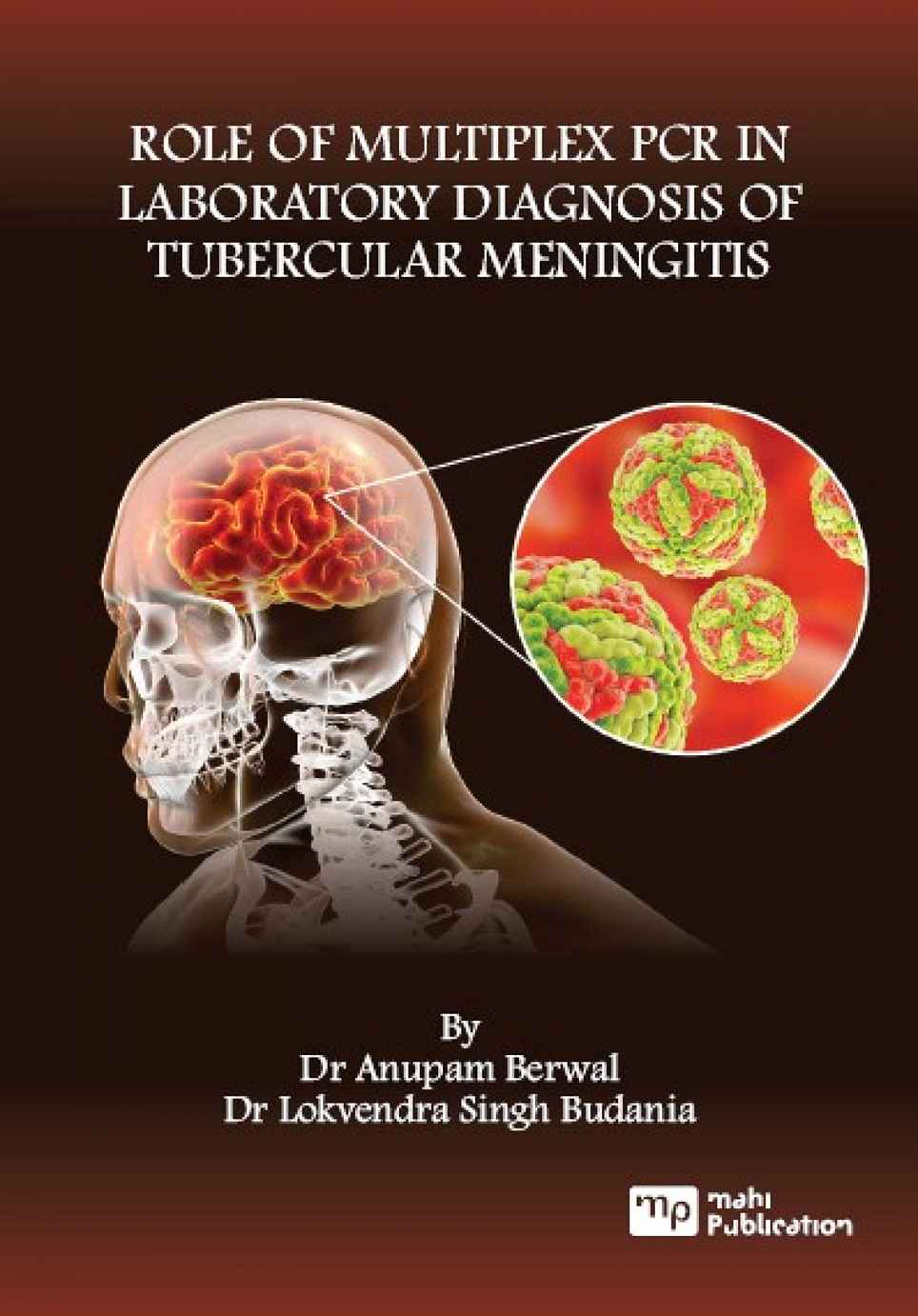 Role Of MultipleX Pcr In Laboratory Diagnosis Of Tubercular Meningitis
