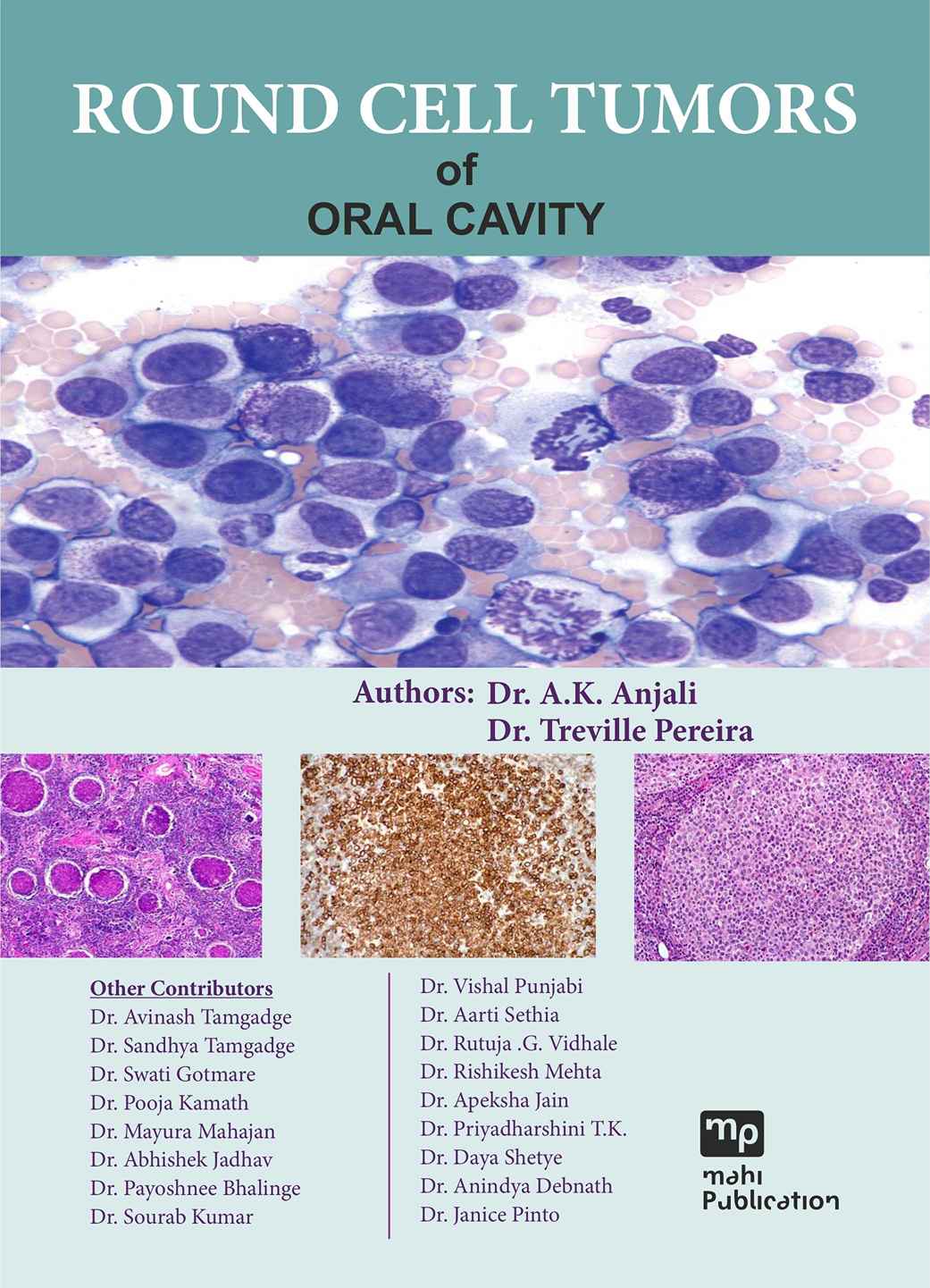 Round Cell Tumors of Oral Cavity