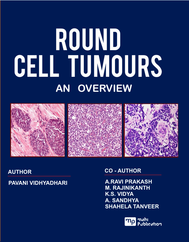 Round Cell Tumours An Overview