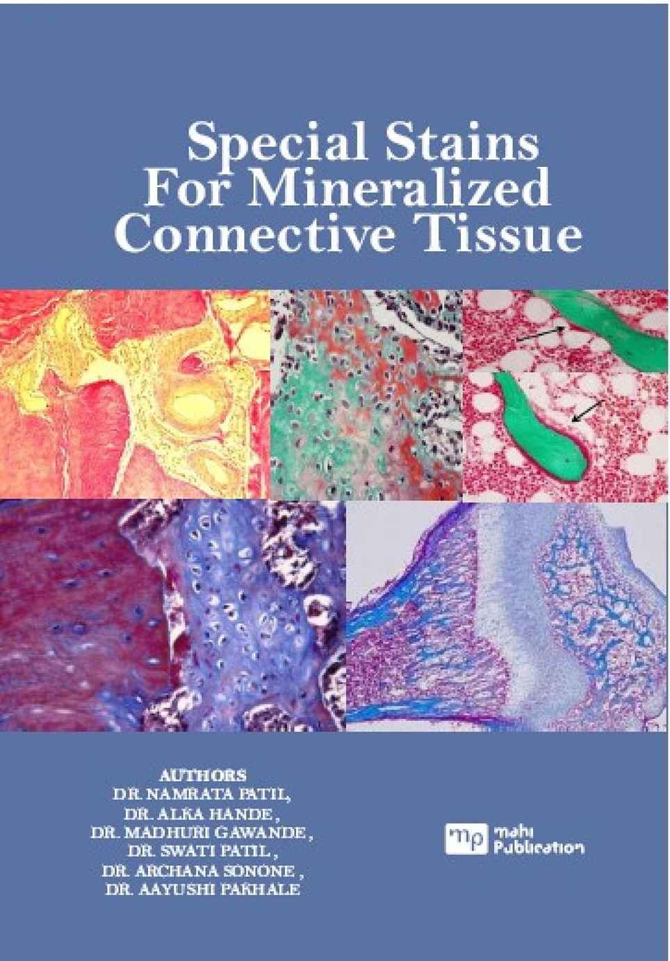 Special Stains for Mineralized Connective Tissue