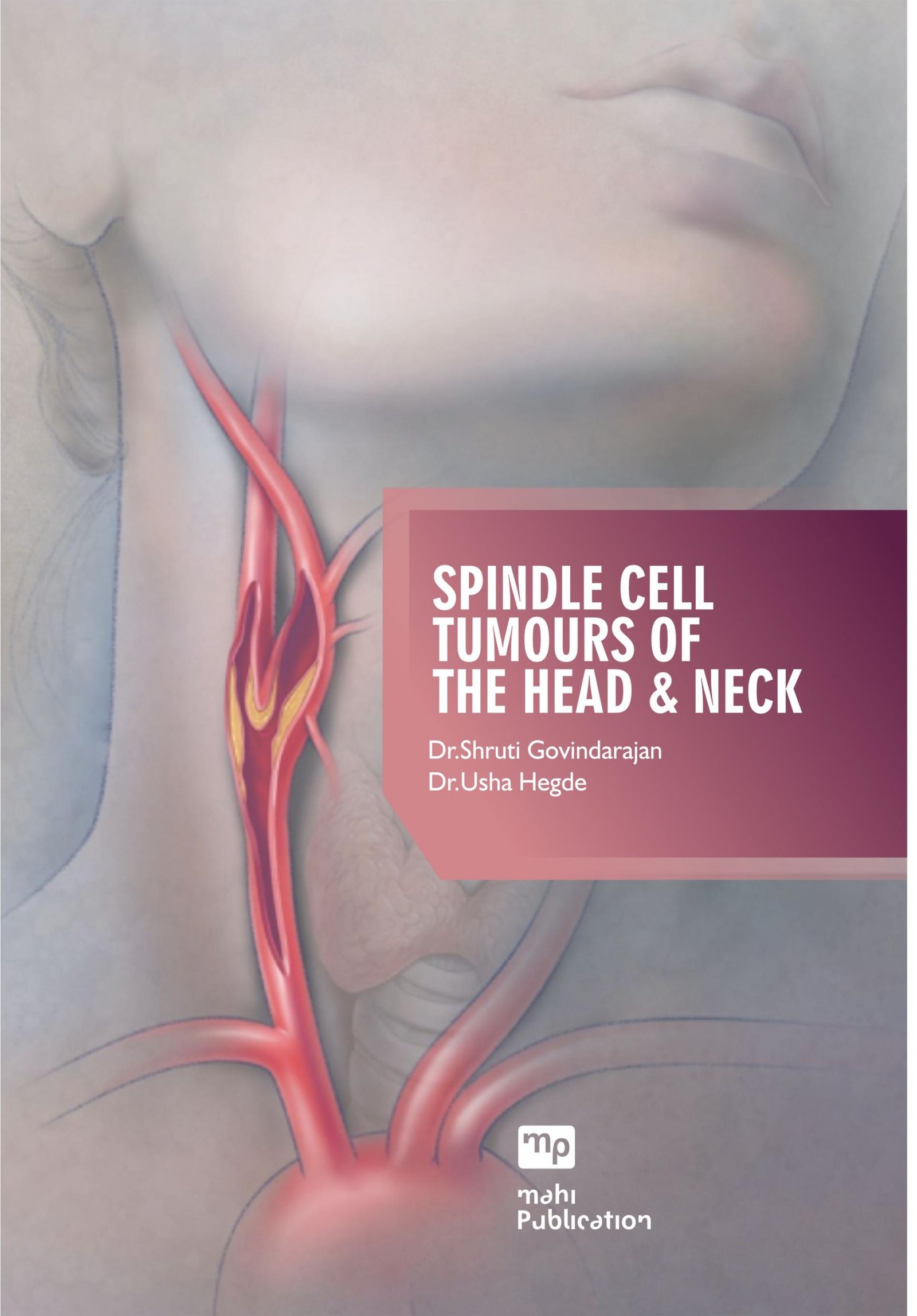 Spindle Cell Tumours of The Head & Neck