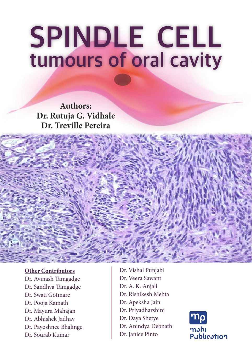 Spindle Cell Tumours of oral cavity