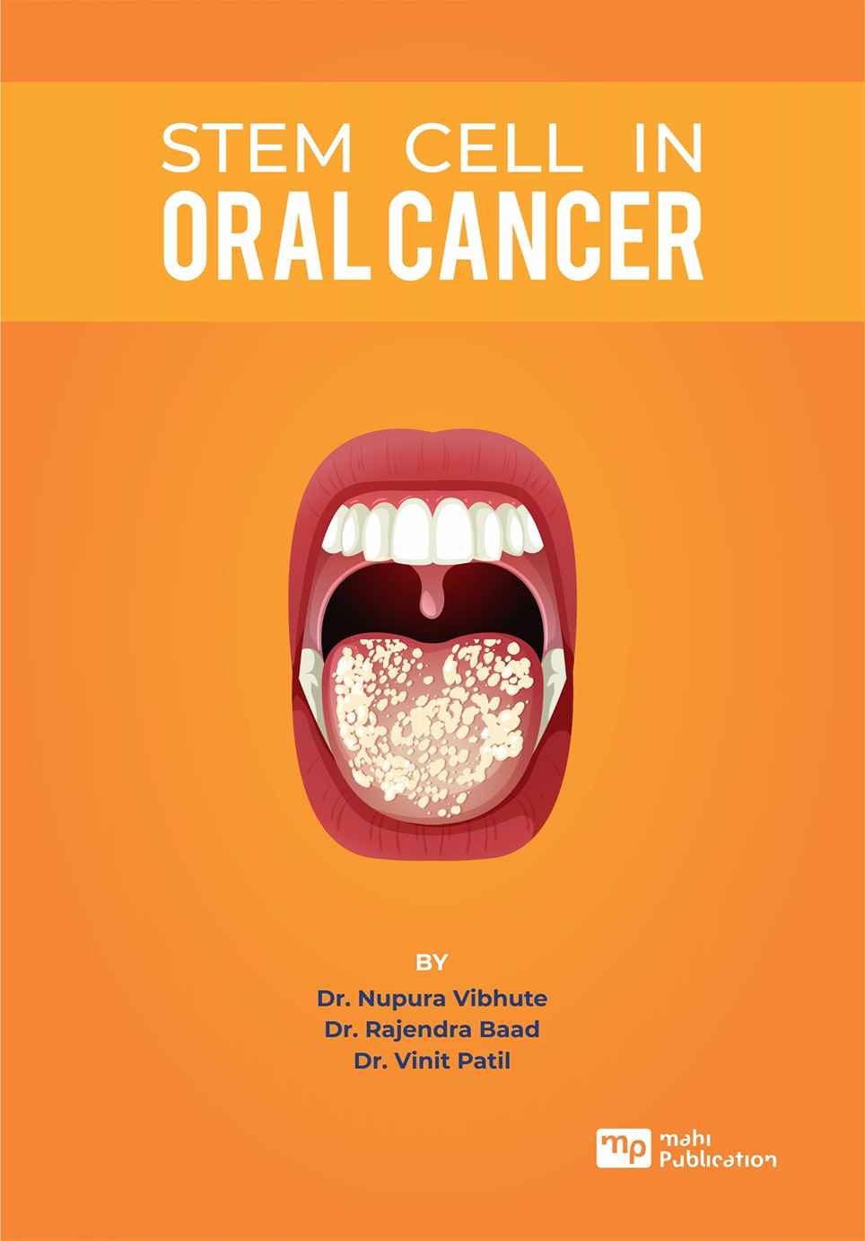 Stem Cell In Oral Cancer