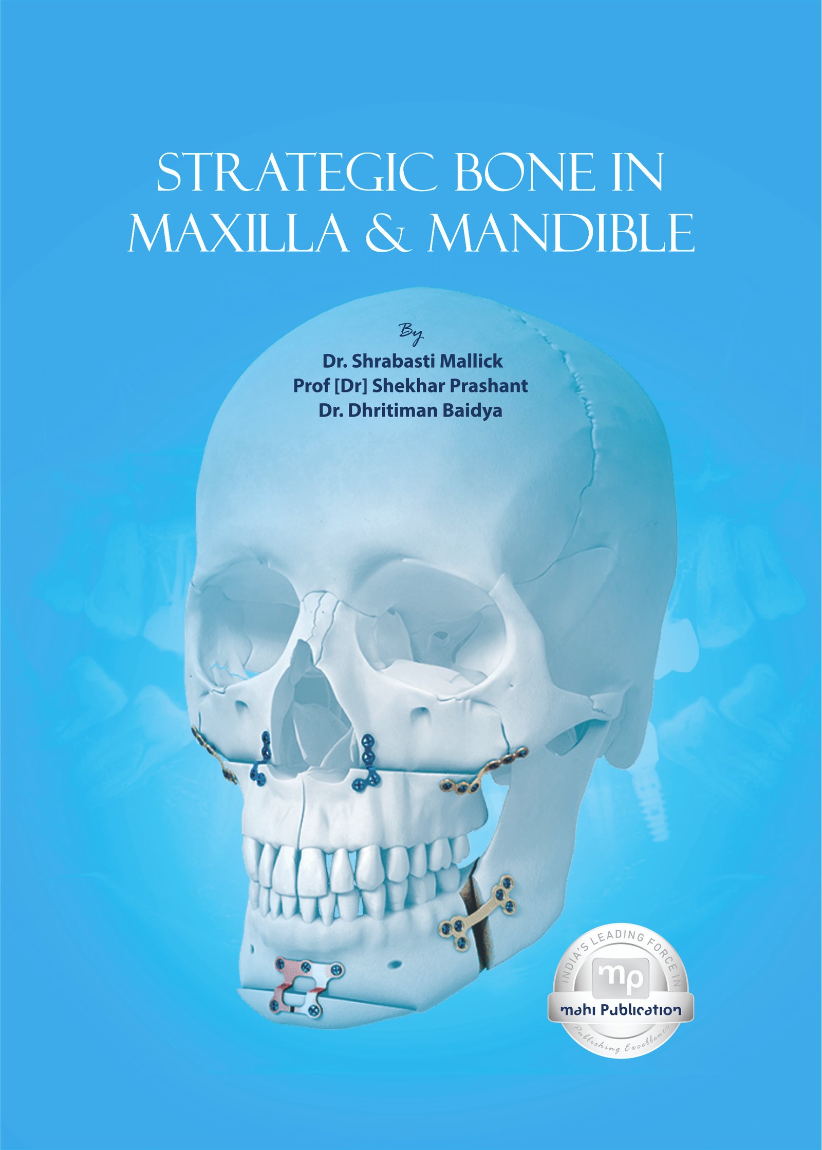 Strategic Bone In Maxilla & Mandible