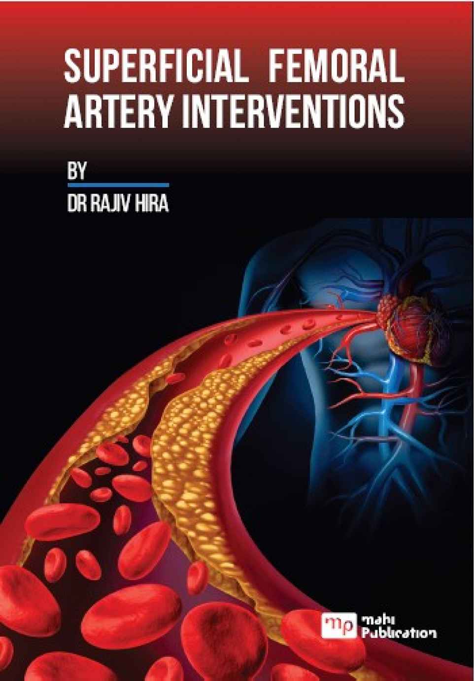 Superficial Femoral Artery Interventions