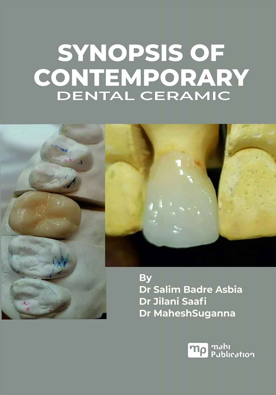 Synopsis of Contemporary Dental Ceramic’s