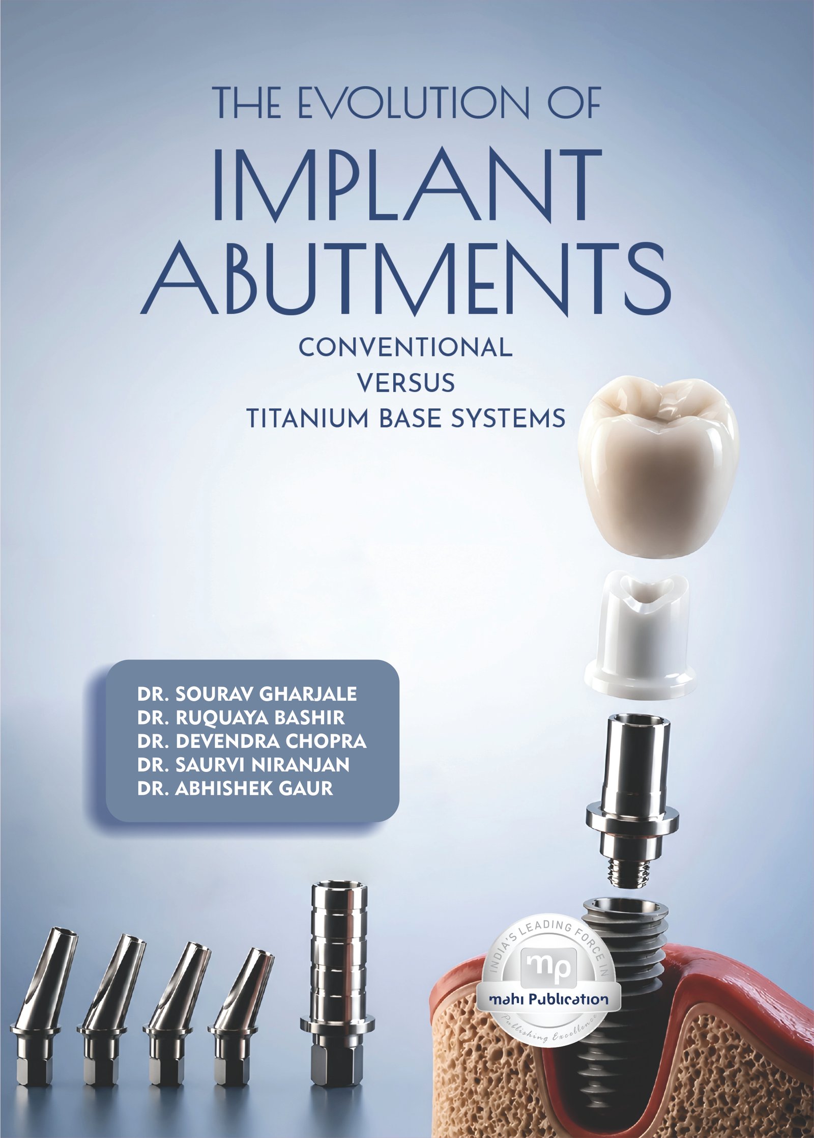 The Evolution of Implant Abutments – Conventional Versus Titanium Base Systems