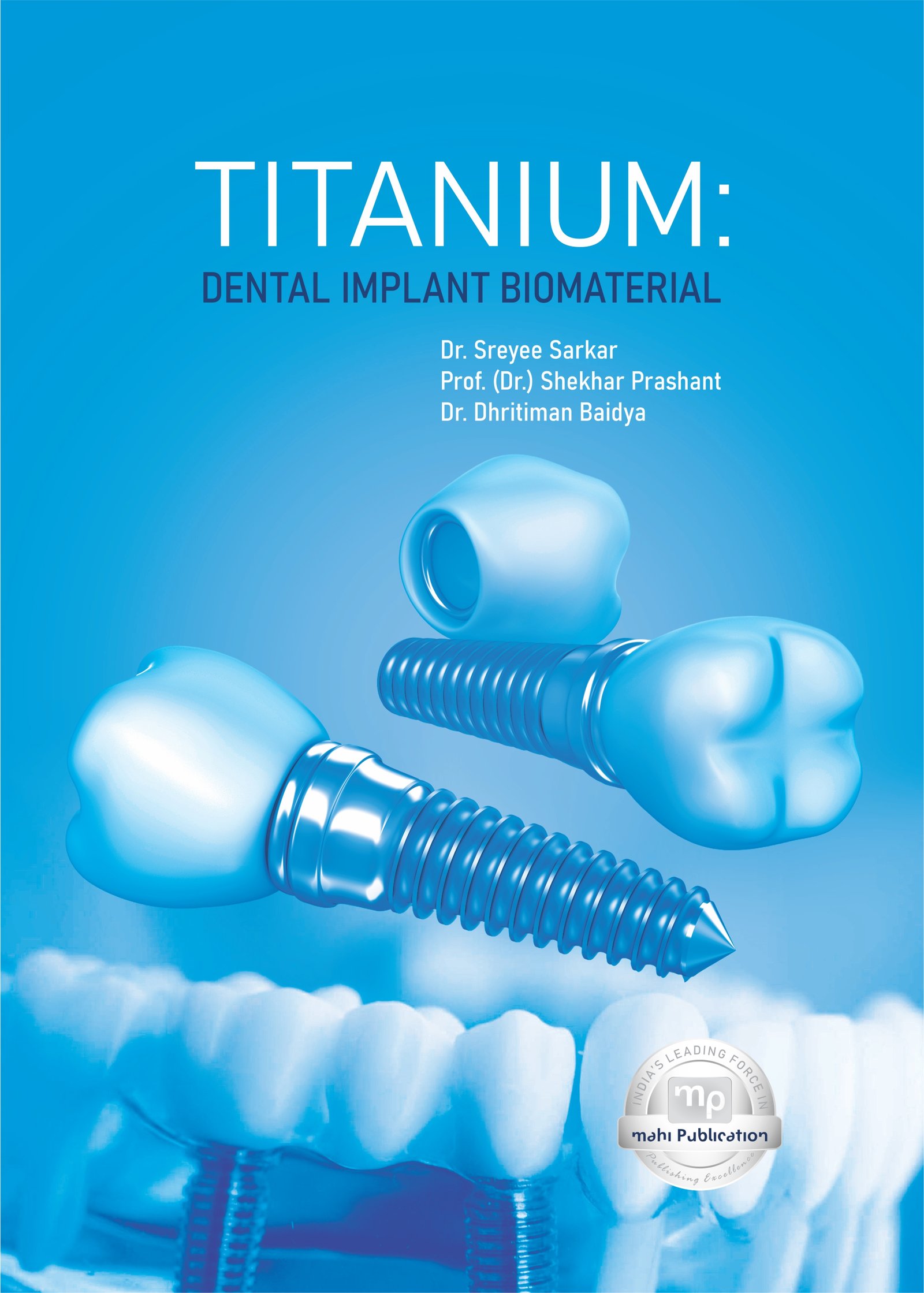 Titanium: Dental Implant Biomaterial
